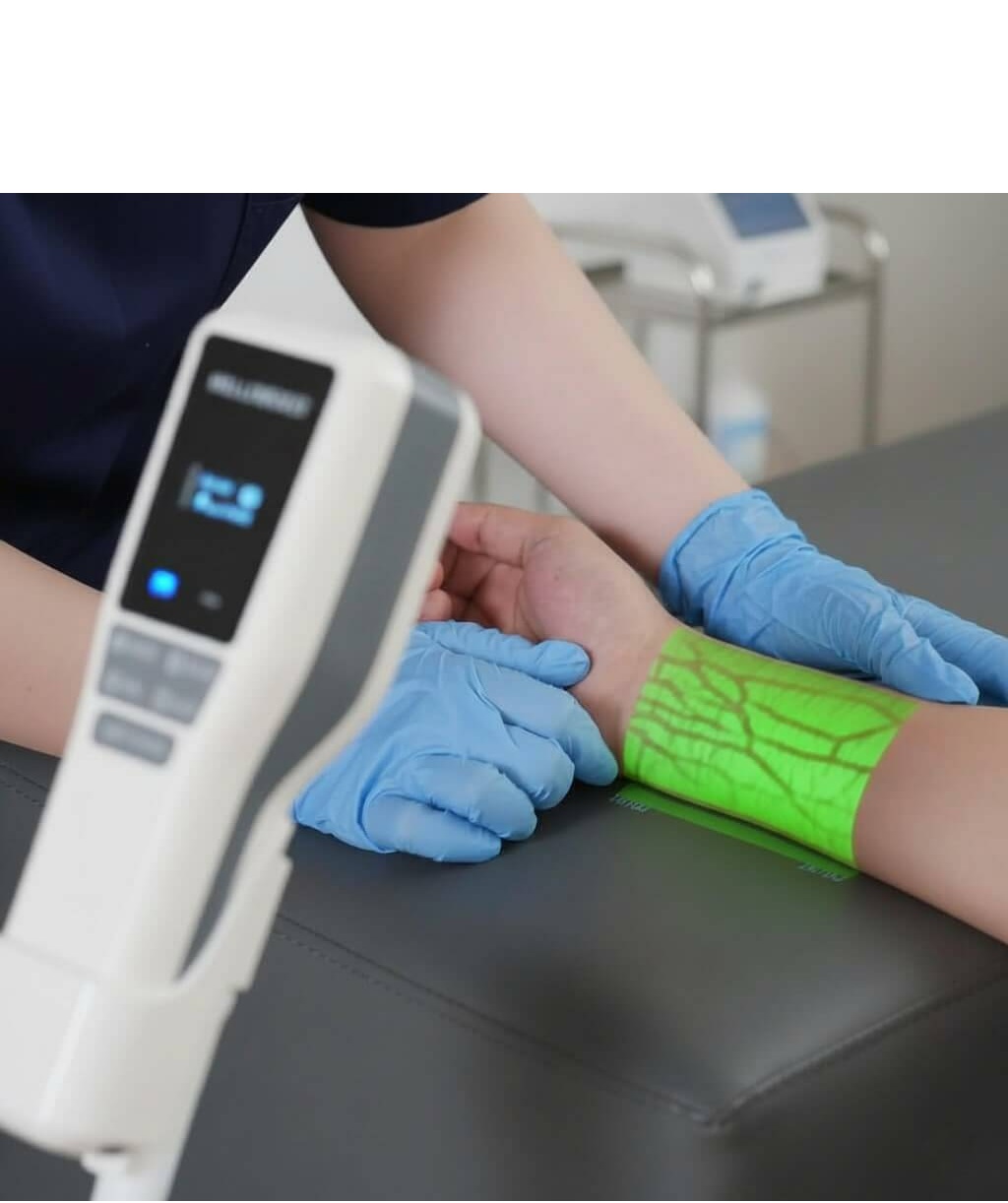 Vein Finder
