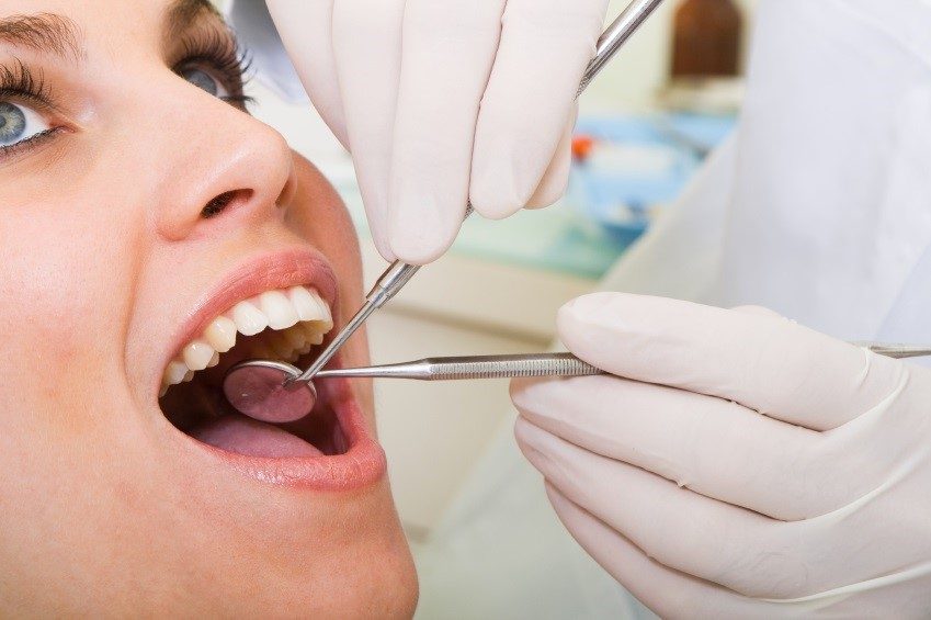 Dental Implants